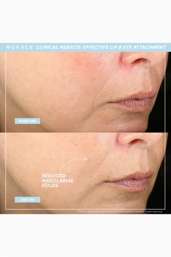 NuFACE® TRINITY+ Lip & Eye Attachment