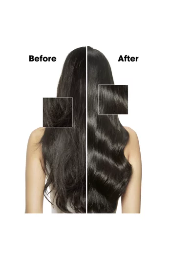 Scalp Advanced 5-in-1 Serum, 90ml